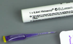 histoacryl