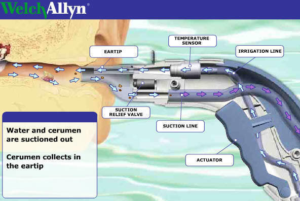 Ear clean systeem